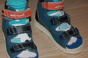 Droen Sandalen fir Hallux valgus an engem Kand