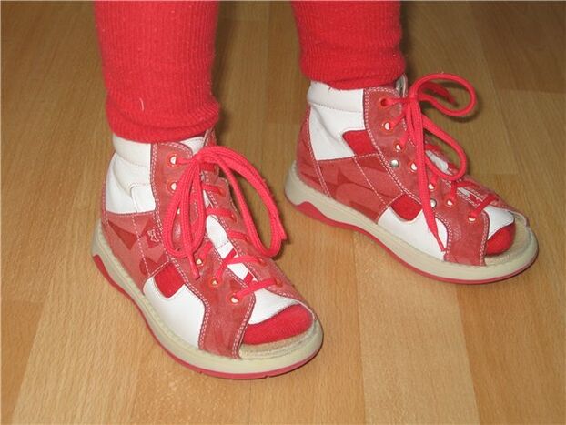Schong fir Kanner mat Hallux valgus