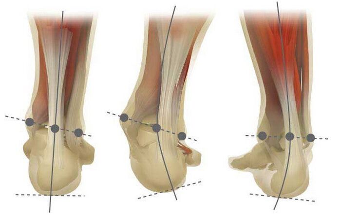 Aarte vu Valgus