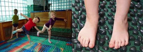 Gymnastik fir Valgus Deformatioun