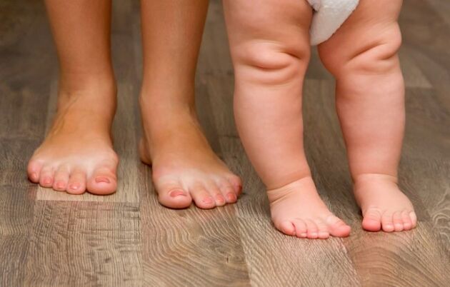 Valgus Verformung vum Fouss bei de Kanner